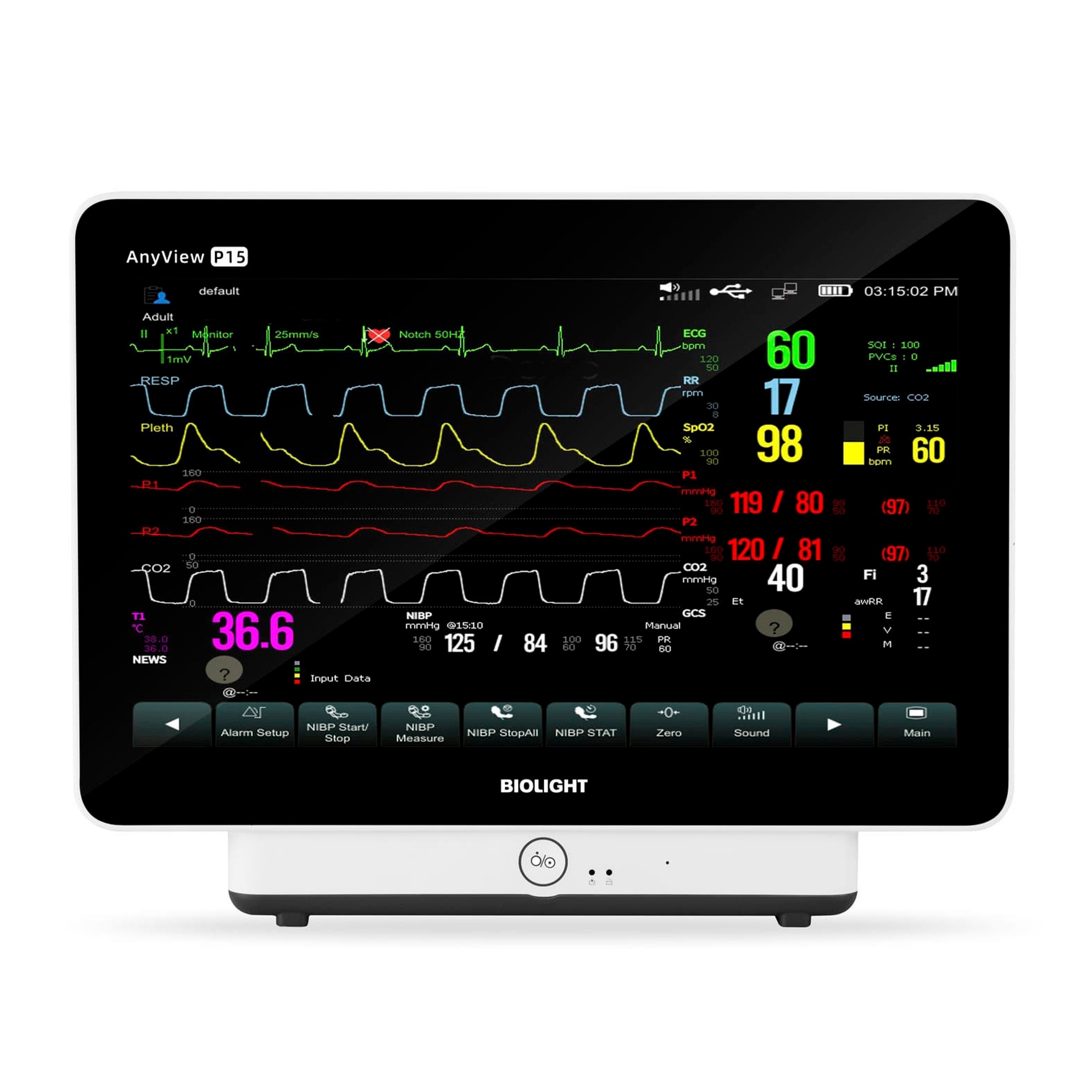 Монитор пациента Biolight AnyView P15