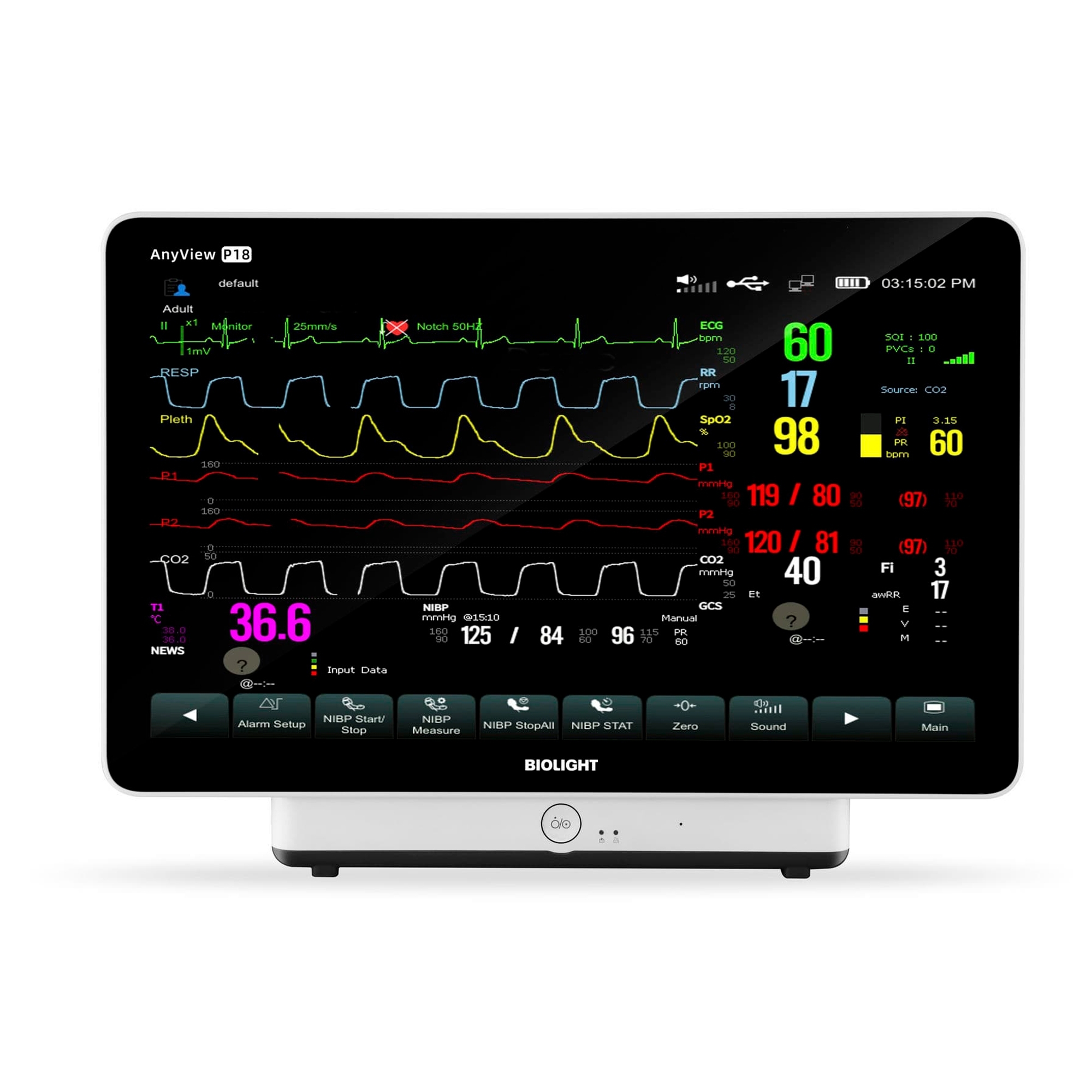 Монитор пациента Biolight AnyView P18