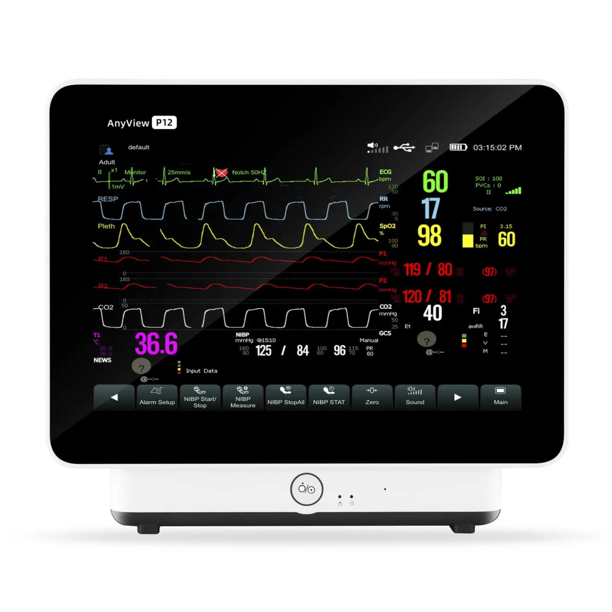Монитор пациента Biolight AnyView P12