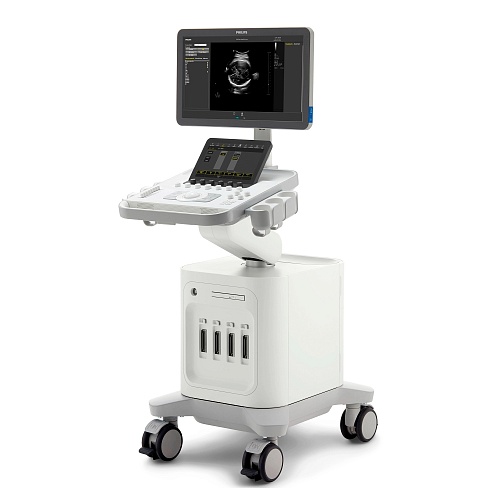 Аппарат УЗИ Philips 3300